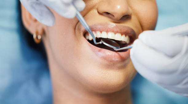Best Emergency Dentist for Knocked-Out Tooth in Woodworth, OH