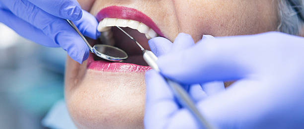 Best Emergency Root Canal Treatment in Woodworth, OH